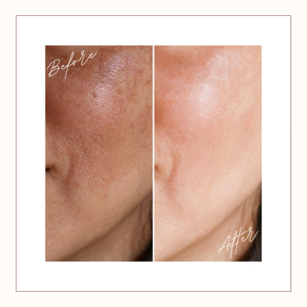Even Tone Face Serum - KABREEM NATURALES