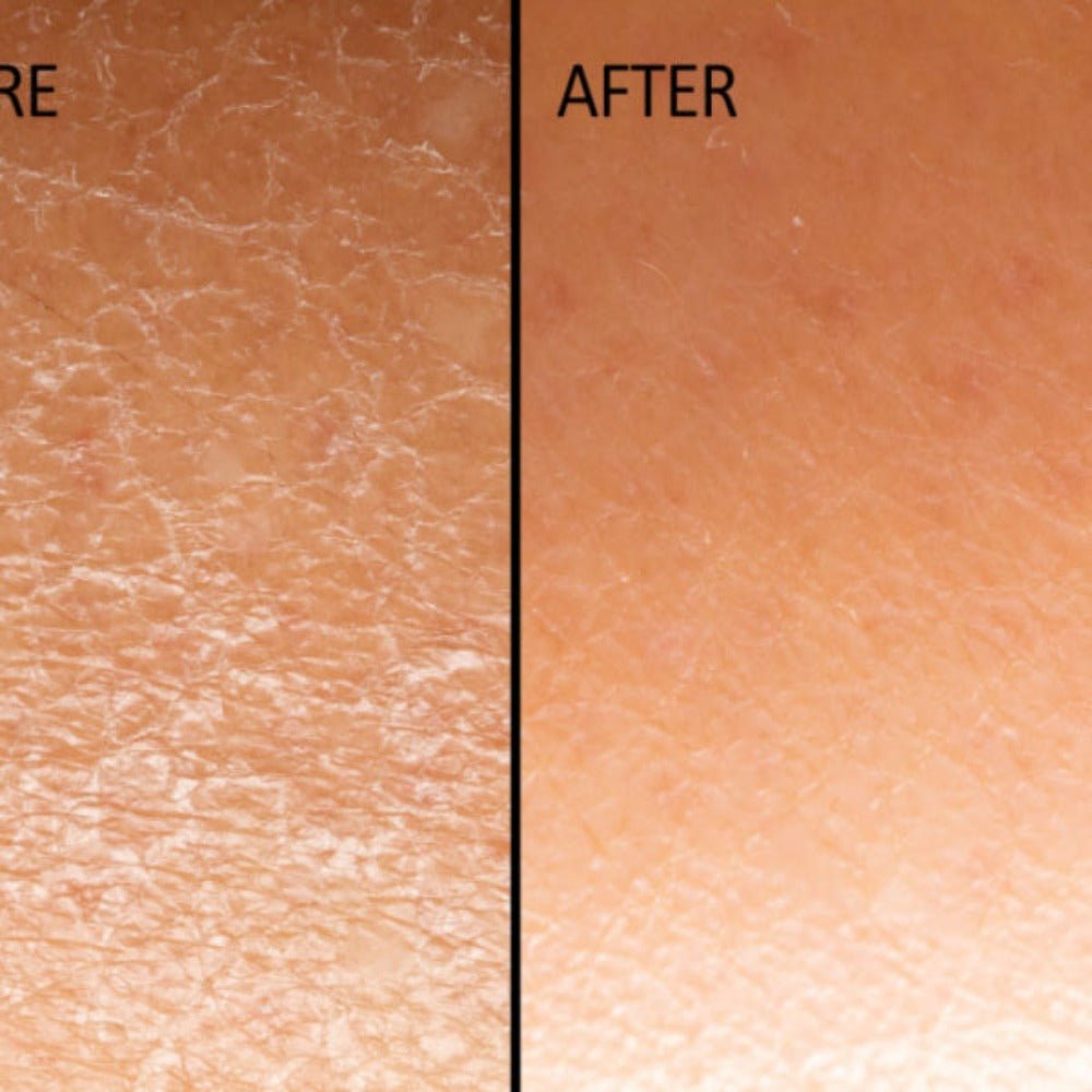 Skin Repair Oil - KABREEM NATURALES